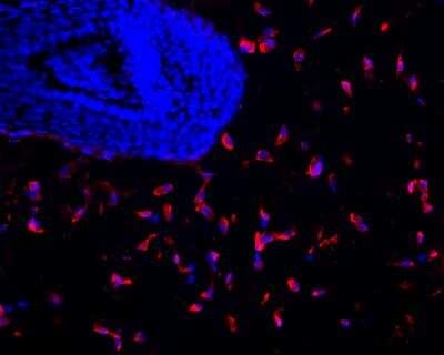 Immunohistochemistry-Frozen: Hsp47 Antibody (M16.10A1) [NBP1-97491]