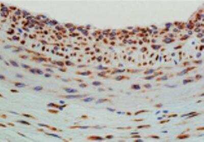 Immunohistochemistry-Paraffin: Hsp47 Antibody (M16.10A1) [NBP1-97491]