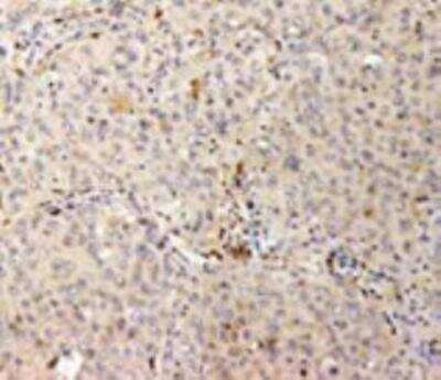 Immunohistochemistry-Paraffin: Hsp47 Antibody (M16.10A1) [NBP1-97491]