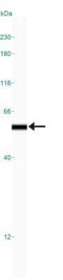 Simple Western: Hsp47 Antibody (M16.10A1) [NBP1-97491]