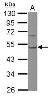 Western Blot: Hsp47 Antibody [NBP2-16893]