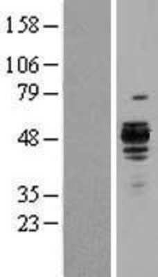 Western Blot: Hsp47 Overexpression Lysate [NBL1-15857]