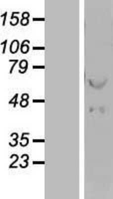 Western Blot: HSP60 Overexpression Lysate [NBL1-11767]