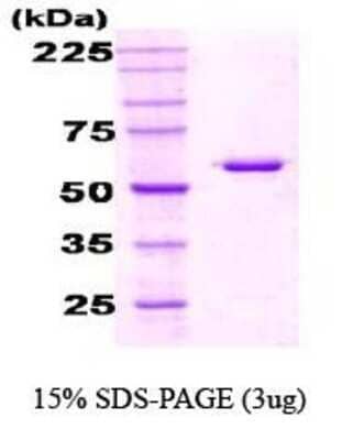 SDS-PAGE: Recombinant E. coli HSP60 Protein [NBC1-18353]