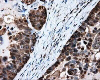 Immunohistochemistry-Paraffin: HSP70/HSPA1A Antibody (OTI3G9) [NBP2-02190]