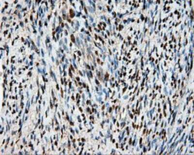 Immunohistochemistry-Paraffin: HSP70/HSPA1A Antibody (OTI3G9) [NBP2-02190]