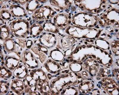 Immunohistochemistry-Paraffin: HSP70/HSPA1A Antibody (OTI3G9) [NBP2-02190]