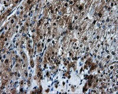 Immunohistochemistry-Paraffin: HSP70/HSPA1A Antibody (OTI3G9) [NBP2-02190]