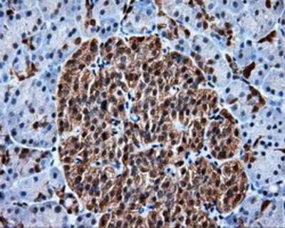 Immunohistochemistry-Paraffin: HSP70/HSPA1A Antibody (OTI3G9) [NBP2-02190]