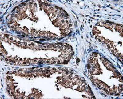 Immunohistochemistry-Paraffin: HSP70/HSPA1A Antibody (OTI3G9) [NBP2-02190]