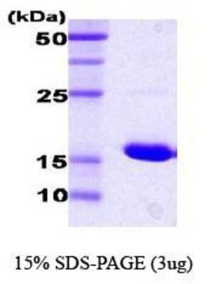 SDS-PAGE: Recombinant E. coli HSP70/HSPA1A Protein [NBC1-18356]