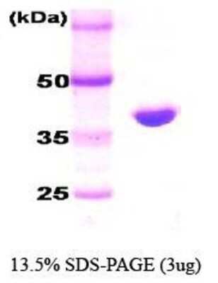 SDS-PAGE: Recombinant E. coli HSP70/HSPA1A Protein [NBC1-18358]