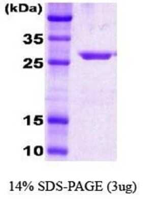 SDS-PAGE: Recombinant E. coli HSP70/HSPA1A Protein [NBC1-18359]