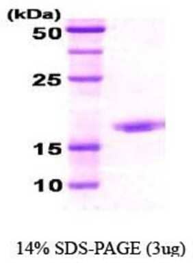 SDS-PAGE: Recombinant E. coli HSP70/HSPA1A Protein [NBC1-18360]