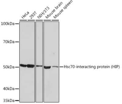 Western Blot: Hsp70 interacting protein HIP Antibody (4A3G8) [NBP3-16829]