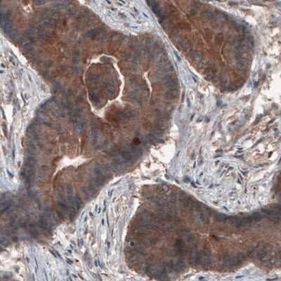 Immunohistochemistry: Hsp70 interacting protein HIP Antibody (CL3708) [NBP2-61615]