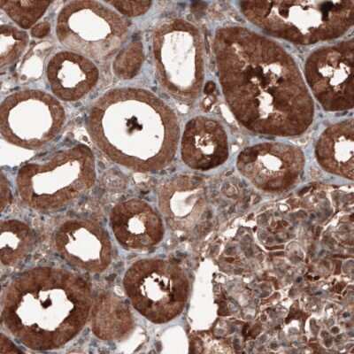 Immunohistochemistry: Hsp70 interacting protein HIP Antibody (CL3708) [NBP2-61615]