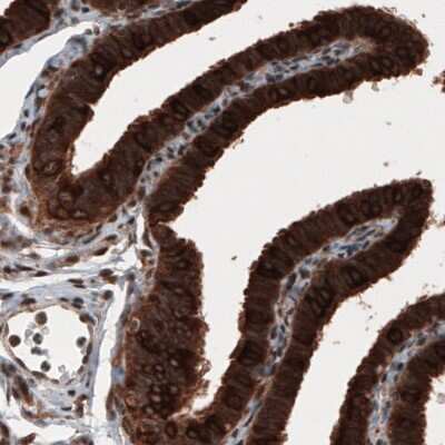 Immunohistochemistry: Hsp70 interacting protein HIP Antibody (CL3708) [NBP2-61615]