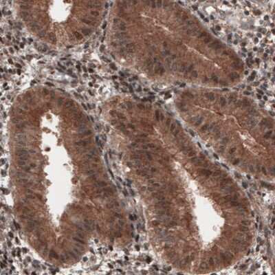 Immunohistochemistry: Hsp70 interacting protein HIP Antibody (CL3708) [NBP2-61615]