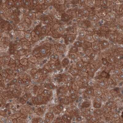 Immunohistochemistry-Paraffin: Hsp70 interacting protein HIP Antibody (CL3708) [NBP2-61615]