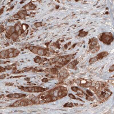 Immunohistochemistry-Paraffin: Hsp70 interacting protein HIP Antibody (CL3708) [NBP2-61615]