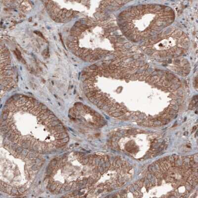 Immunohistochemistry-Paraffin: Hsp70 interacting protein HIP Antibody (CL3708) [NBP2-61615]