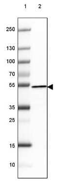 Western Blot: Hsp70 interacting protein HIP Antibody (CL3708) [NBP2-61615]