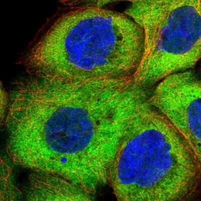 Immunocytochemistry/ Immunofluorescence: Hsp70 interacting protein HIP Antibody [NBP2-48786]