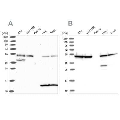 Western Blot: Hsp70 interacting protein HIP Antibody [NBP2-47427]