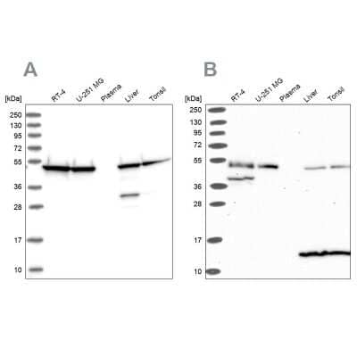 Western Blot: Hsp70 interacting protein HIP Antibody [NBP2-48865]