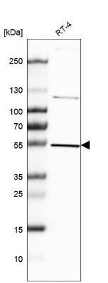 Western Blot: Hsp70 interacting protein HIP Antibody [NBP2-48866]