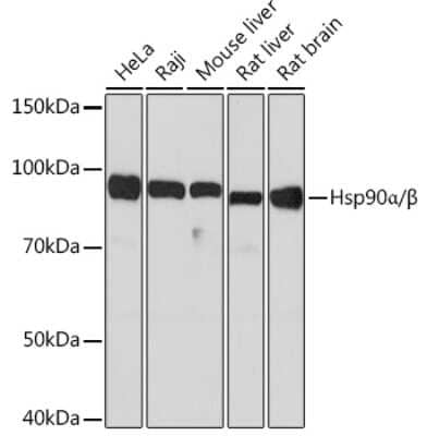 Western Blot: Hsp90A/B Antibody (5D7Y6) [NBP3-16532]