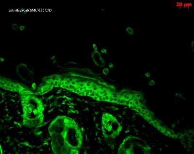 Immunohistochemistry: Hsp90A/B Antibody (Hyb-K41220A) [NB110-96870]