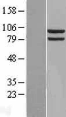 Western Blot: HSP90 alpha Overexpression Lysate [NBL1-11743]