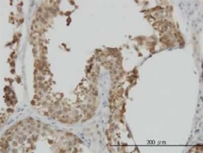 Immunohistochemistry-Paraffin: HspA1L Antibody (7H6) [H00003305-M02]