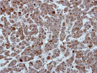 Immunohistochemistry-Paraffin: HspA1L Antibody [NBP1-33022]