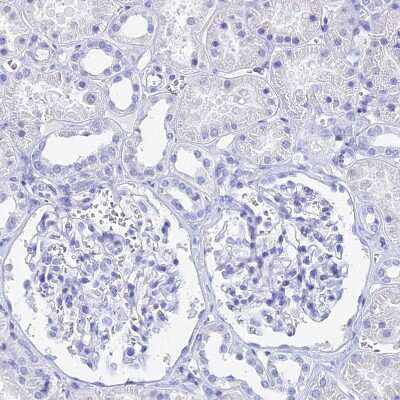 Immunohistochemistry-Paraffin: HspA1L Antibody [NBP1-92012]