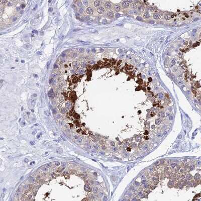 Immunohistochemistry-Paraffin: HspA1L Antibody [NBP1-92012]