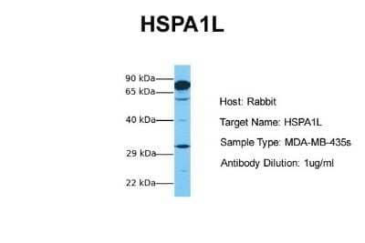 Western Blot: HspA1L Antibody [NBP1-56938]