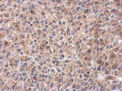 Immunohistochemistry-Paraffin: HSPA2 Antibody [NBP2-16897]