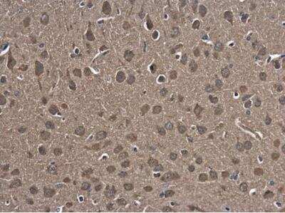 Immunohistochemistry-Paraffin: HspA4 Antibody [NBP1-33425]