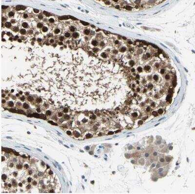 Immunohistochemistry-Paraffin: HspA4 Antibody [NBP1-81696]