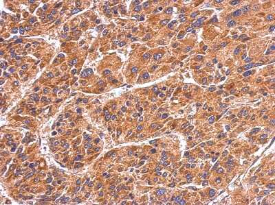 Immunohistochemistry-Paraffin: HspA4 Antibody [NBP2-16898]