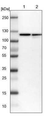 Western Blot: HspA4 Antibody [NBP1-81696]