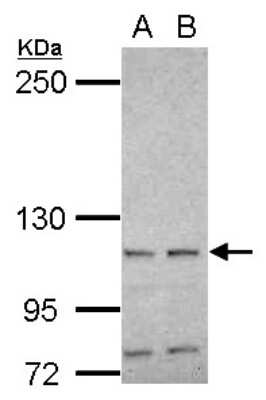 Western Blot: HspA4 Antibody [NBP2-16898]