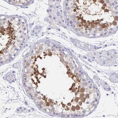 Immunohistochemistry: HspA4L Antibody [NBP2-49333]