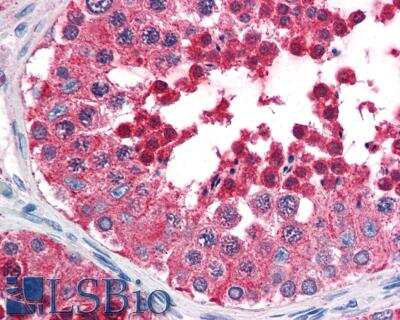 Immunohistochemistry-Paraffin: HspA4L Antibody [NB100-94907]