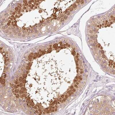 Immunohistochemistry-Paraffin: HspA4L Antibody [NBP2-48700]