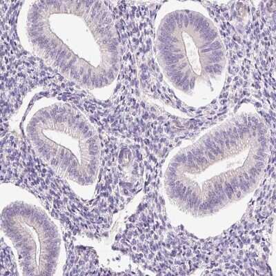 Immunohistochemistry-Paraffin: HspA4L Antibody [NBP2-48700]
