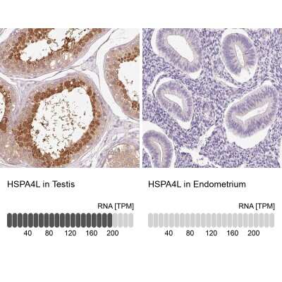 Immunohistochemistry-Paraffin: HspA4L Antibody [NBP2-48700]